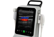 Современные методы УЗИ-диагностики: что выбрать